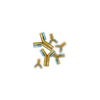 antibody-ebv_1236193414